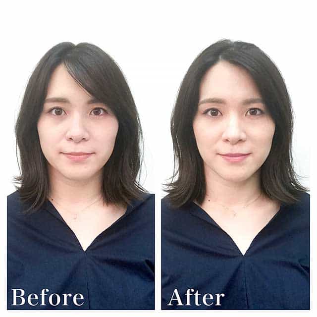 Before & After