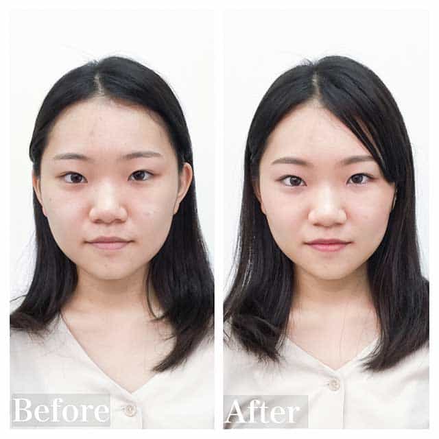 Before & After