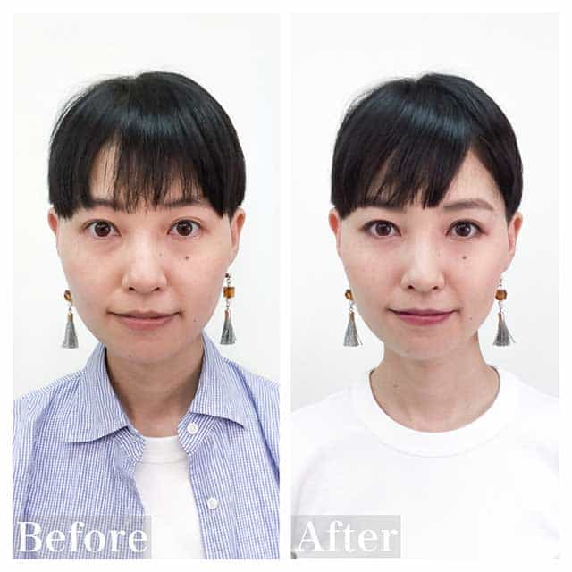 Before & After