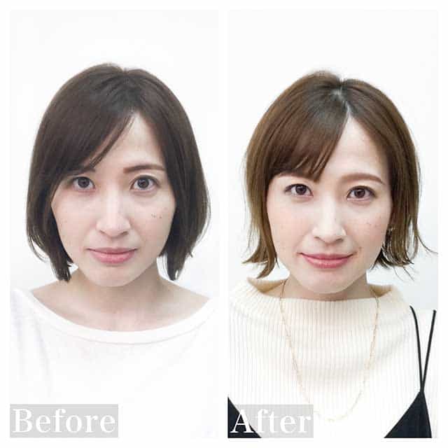 Before & After