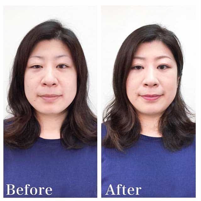 Before & After