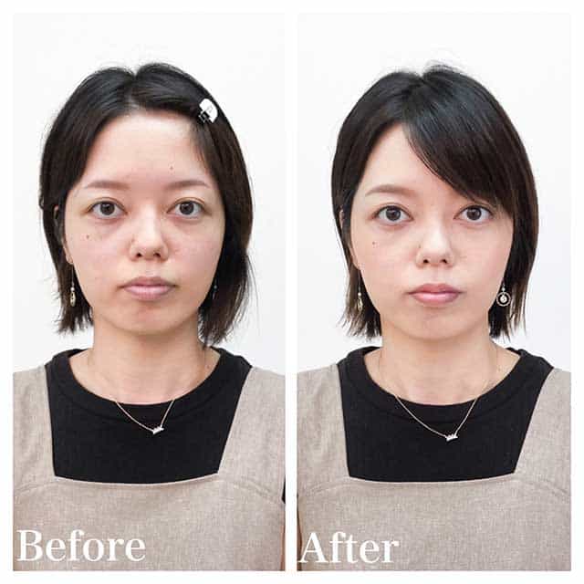 Before & After